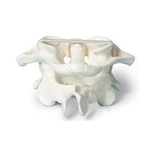 Oversized Atlas/Axis Cervical Vertebrae Spine Model (Made in USA 