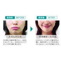 Face Shaping Cheek Slimming Slim Mouth Piece Oval  