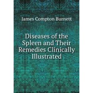  Diseases of the Spleen and Their Remedies Clinically 
